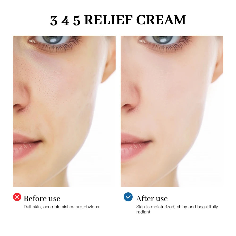Korean Relief Cream Your Skin