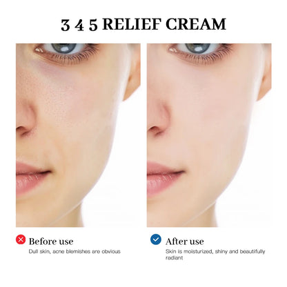 Korean Relief Cream Your Skin